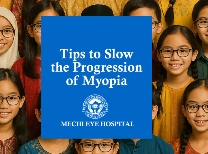 Tips to Slow the Progression of Myopia
